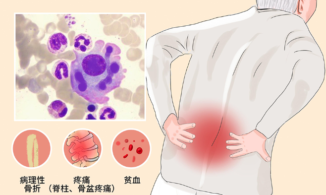 邵陽創(chuàng)傷骨科,邵陽風濕病區(qū),邵陽骨質增生,邵陽關節(jié)病區(qū),邵陽頸椎病區(qū)